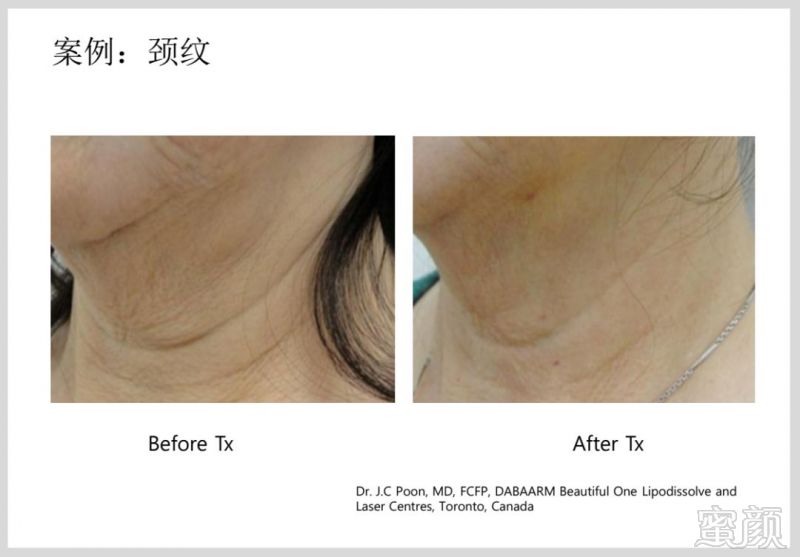 https://img.miyanlife.com/mnt/timg/181224/12291C518-8.jpg