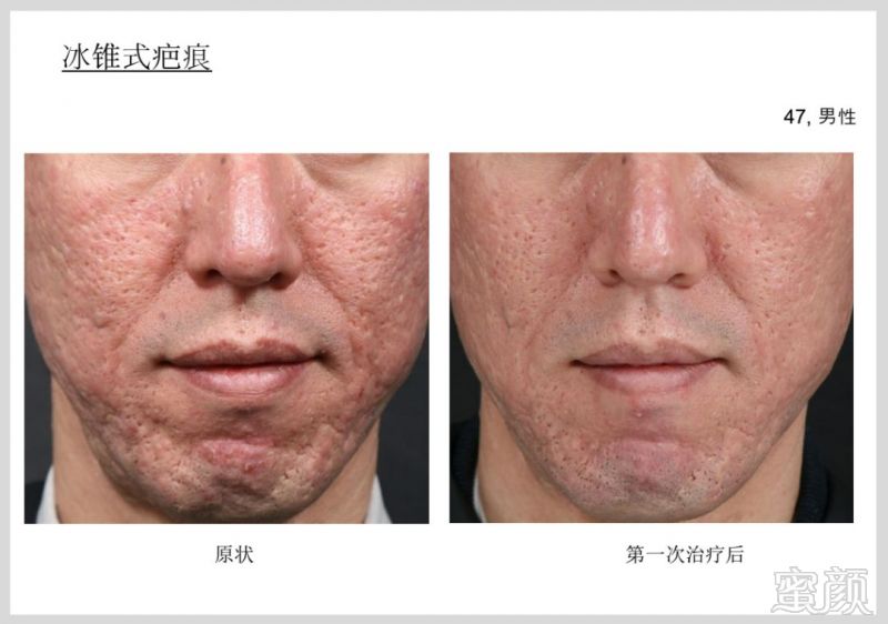 https://img.miyanlife.com/mnt/timg/181224/12291H204-11.jpg