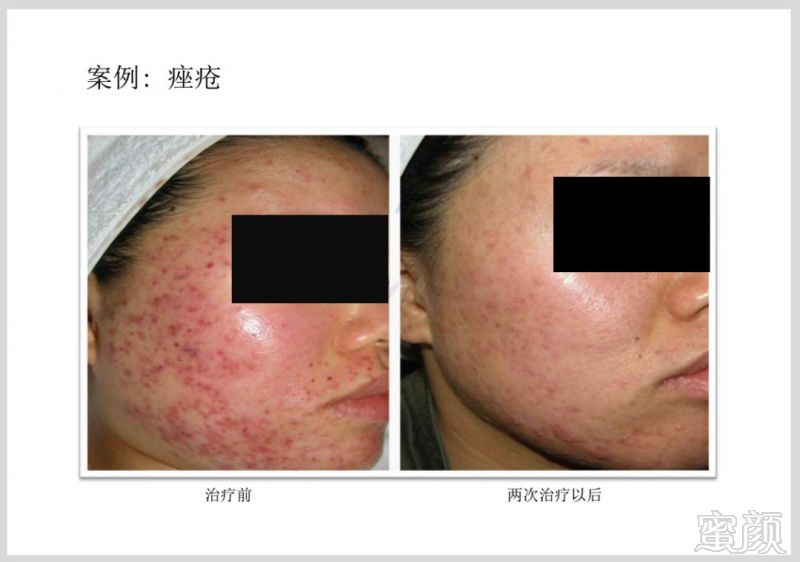 https://img.miyanlife.com/mnt/timg/181224/12291J018-12.jpg