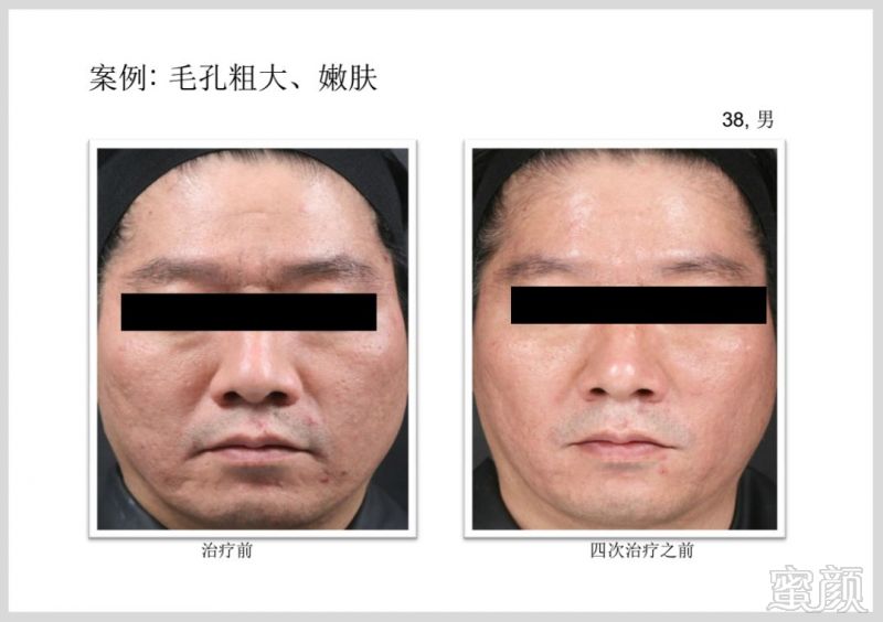 https://img.miyanlife.com/mnt/timg/181224/12291K029-13.jpg