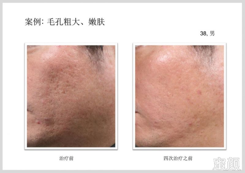 https://img.miyanlife.com/mnt/timg/181224/12291WM6-14.jpg
