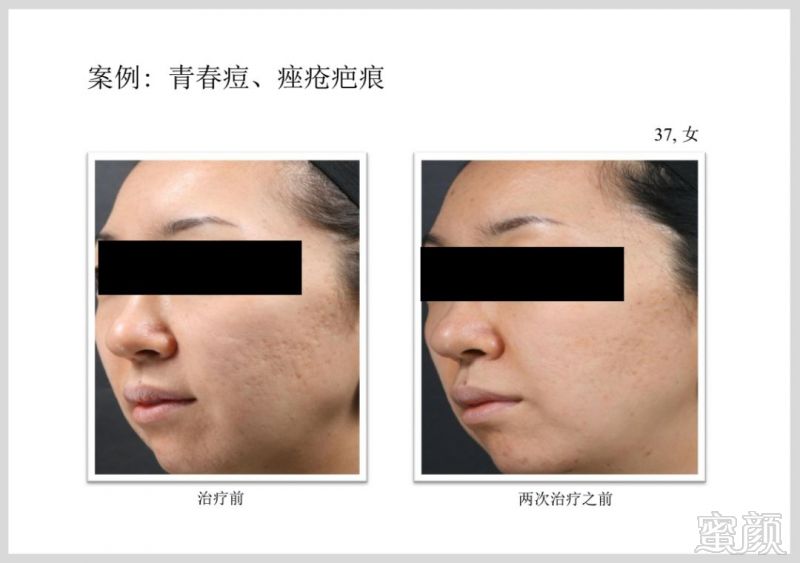 https://img.miyanlife.com/mnt/timg/181224/12291WZ6-15.jpg