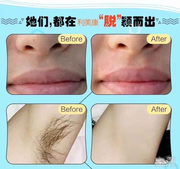 https://img.miyanlife.com/mnt/timg/181224/12425H021-14.jpg