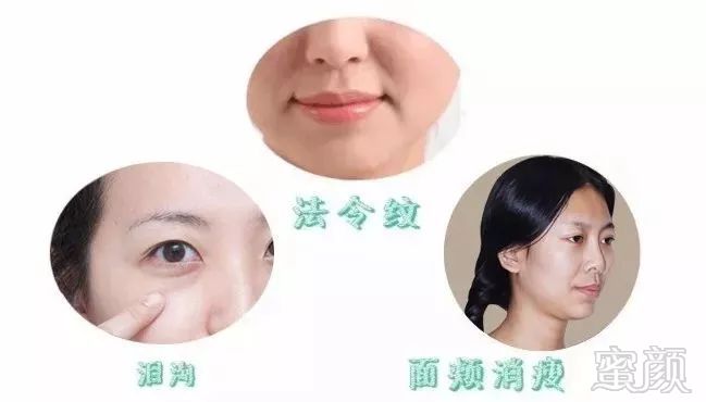 https://img.miyanlife.com/mnt/timg/181224/1246315T1-1.jpg
