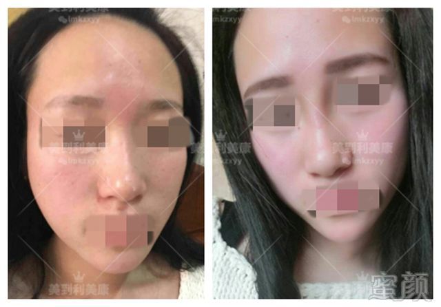 https://img.miyanlife.com/mnt/timg/181224/1246352B6-8.jpg