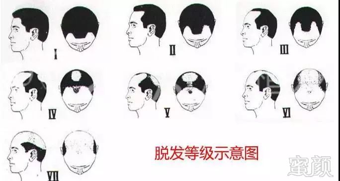 https://img.miyanlife.com/mnt/timg/181225/1251445362-1.jpg