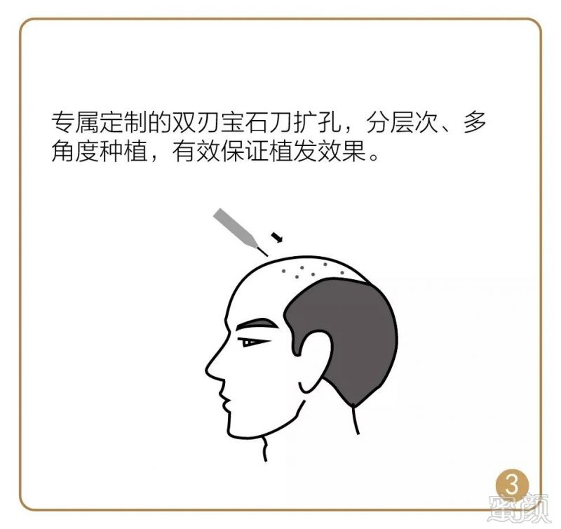 https://img.miyanlife.com/mnt/timg/181225/125145HN-7.jpg