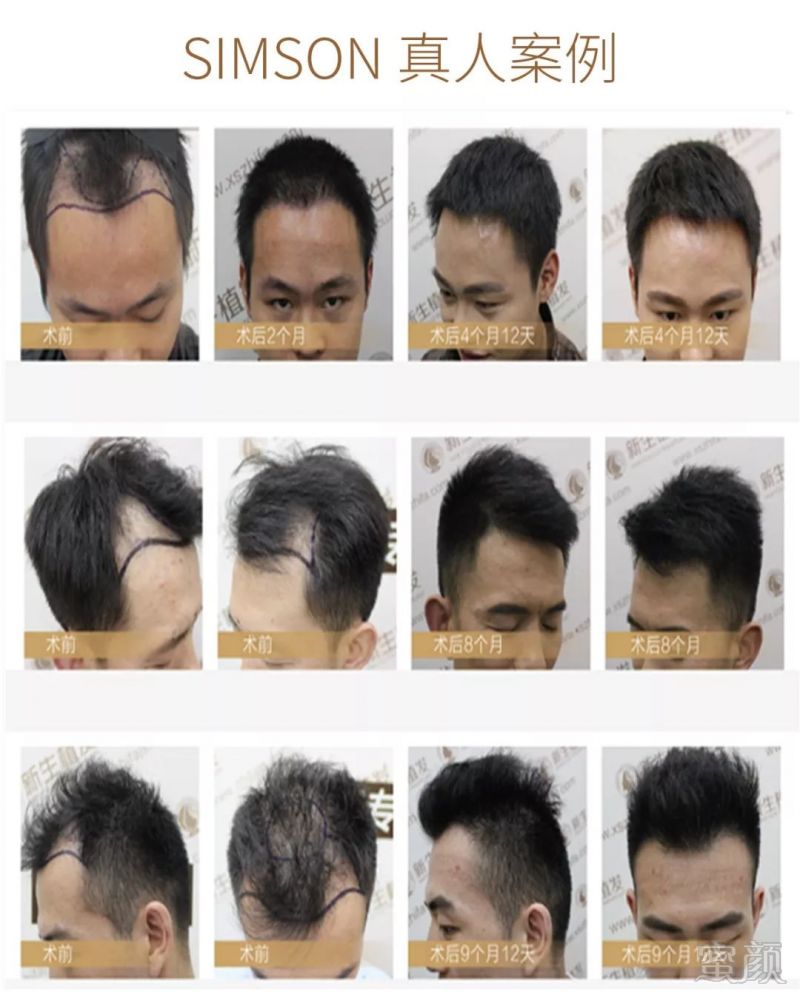 https://img.miyanlife.com/mnt/timg/181225/1251463396-13.jpg