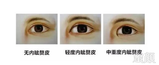 https://img.miyanlife.com/mnt/timg/181225/1329304344-4.jpg