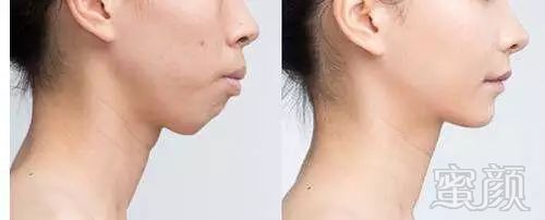https://img.miyanlife.com/mnt/timg/181225/1343091507-2.jpg