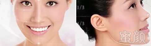 https://img.miyanlife.com/mnt/timg/181225/13430a544-1.jpg