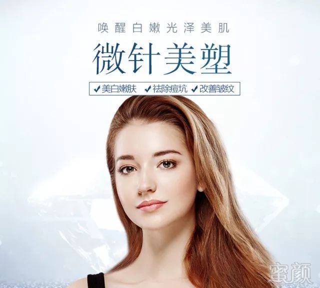 https://img.miyanlife.com/mnt/timg/181226/115T34106-2.jpg