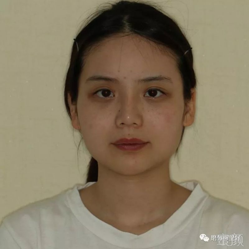 https://img.miyanlife.com/mnt/timg/181226/1215115338-0.jpg