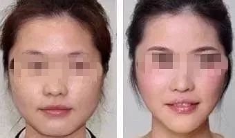 https://img.miyanlife.com/mnt/timg/181226/122J92028-8.jpg