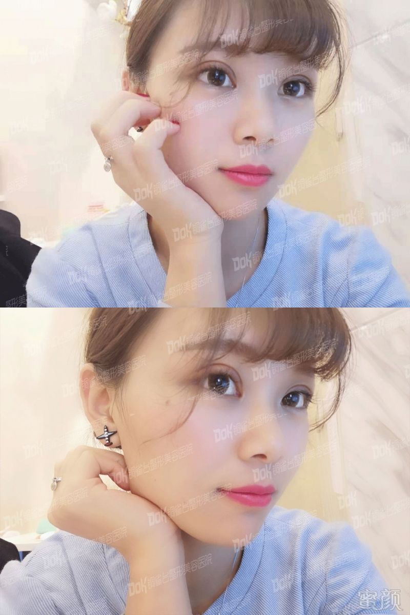 https://img.miyanlife.com/mnt/timg/181226/1230113428-15.jpg