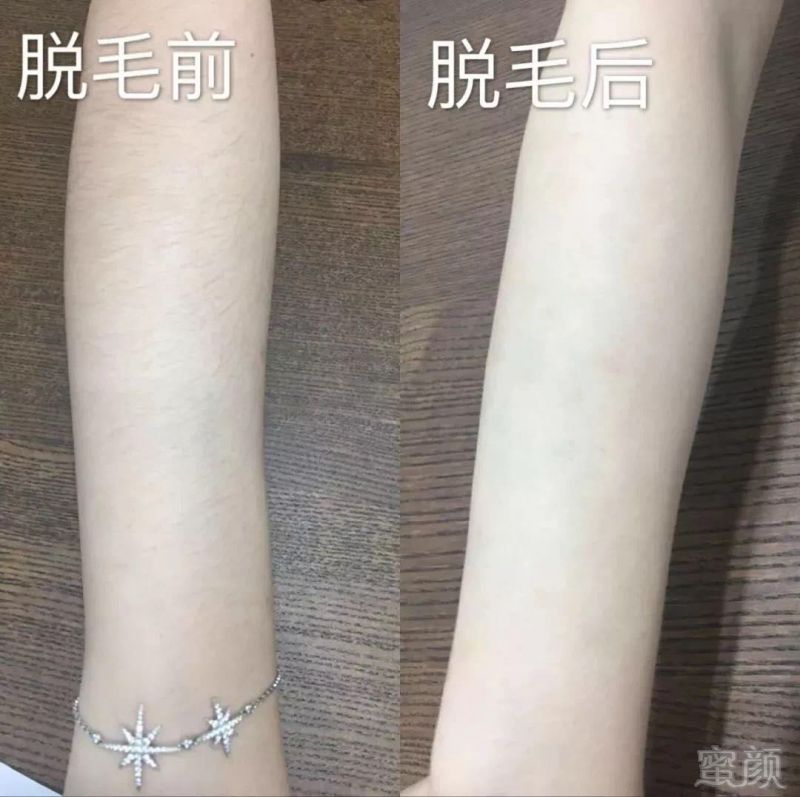 https://img.miyanlife.com/mnt/timg/181227/113213G46-5.jpg