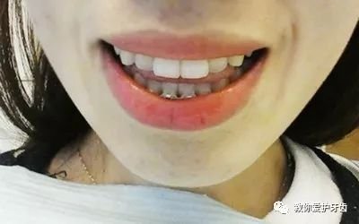 https://img.miyanlife.com/mnt/timg/181227/12353420D-3.jpg