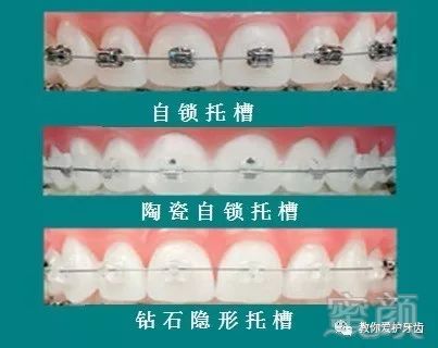 https://img.miyanlife.com/mnt/timg/181227/123534OC-2.jpg