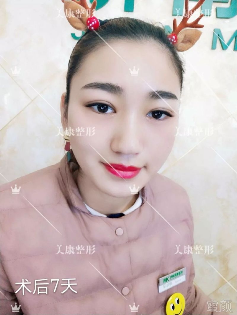 https://img.miyanlife.com/mnt/timg/181227/1334062494-3.jpg