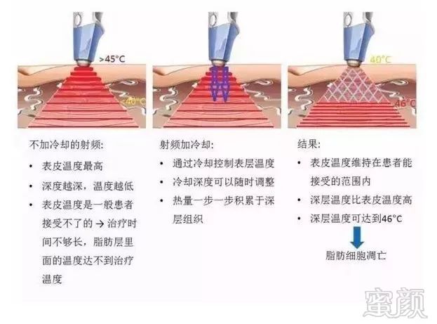 案例图片