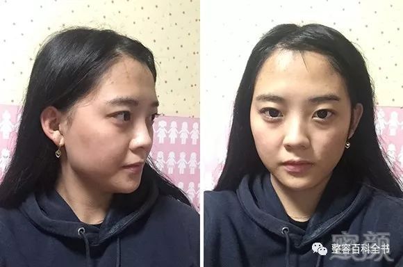 https://img.miyanlife.com/mnt/timg/181227/133Z02623-0.jpg