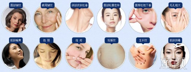 https://img.miyanlife.com/mnt/timg/181228/112TMT4-6.jpg