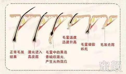 https://img.miyanlife.com/mnt/timg/181228/1135204215-2.jpg