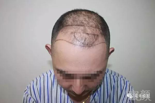 https://img.miyanlife.com/mnt/timg/181228/113IM636-1.jpg