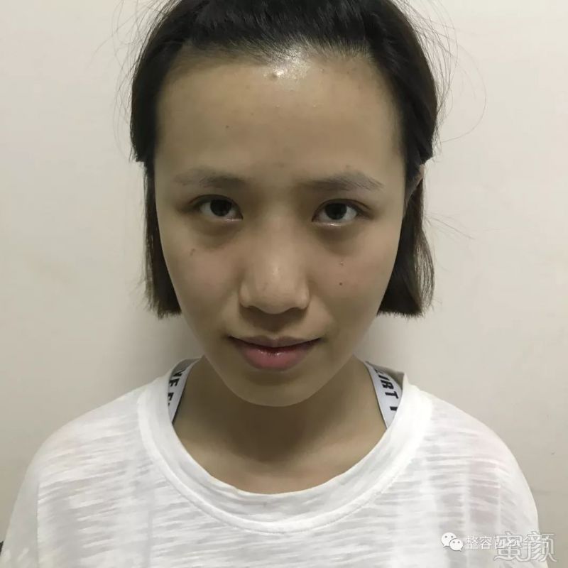 https://img.miyanlife.com/mnt/timg/181228/115GUc8-0.jpg