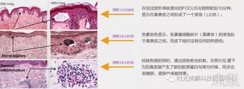 案例图片