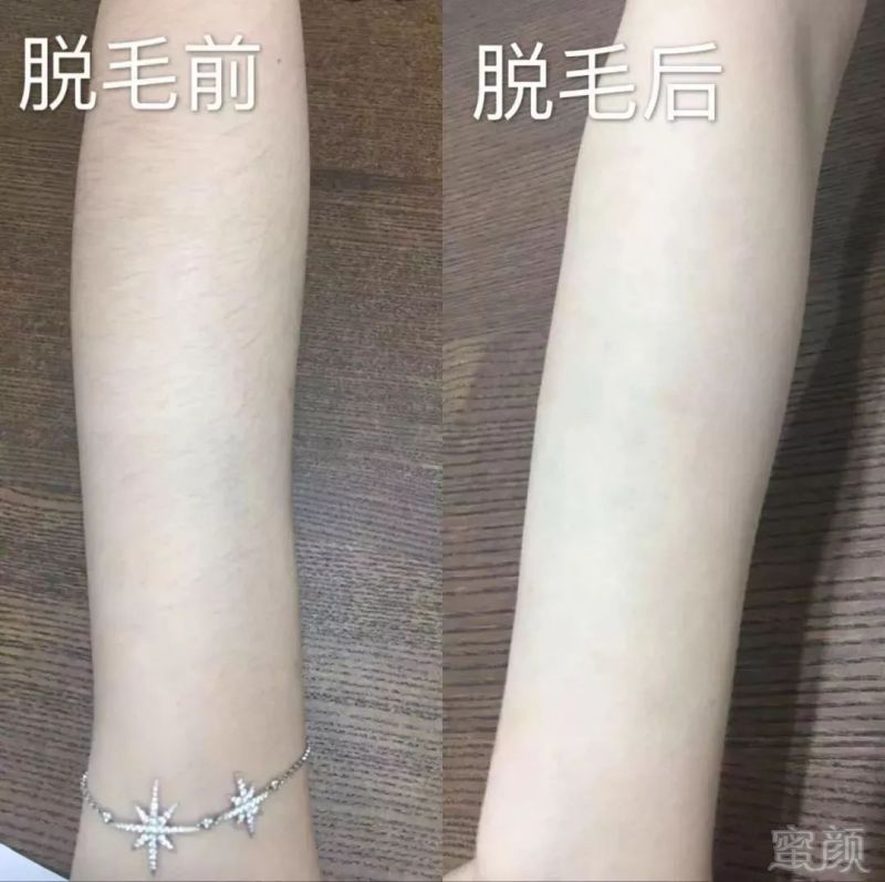 https://img.miyanlife.com/mnt/timg/181228/1210325436-7.jpg