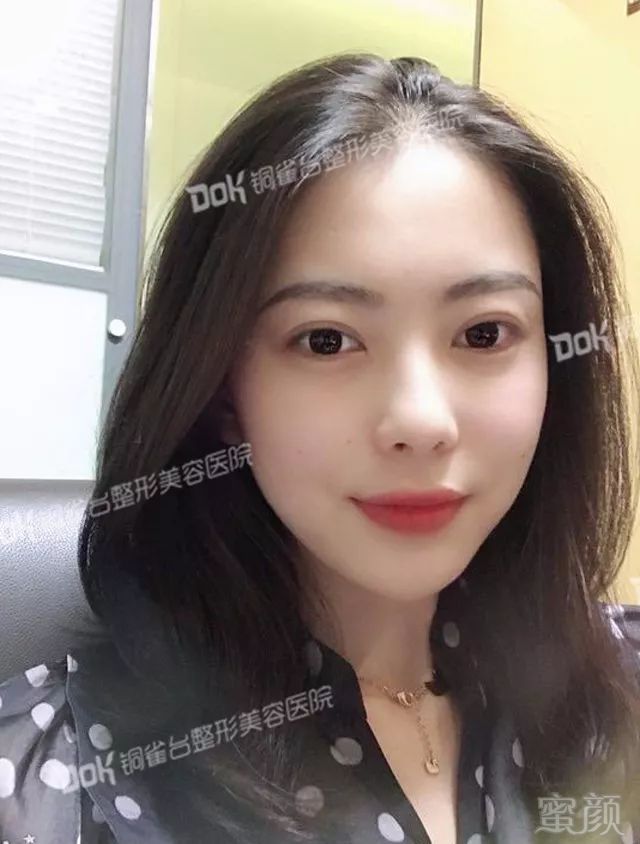 https://img.miyanlife.com/mnt/timg/181228/121P54137-10.jpg
