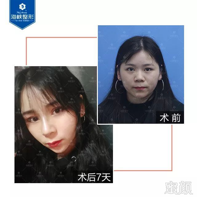 案例图片