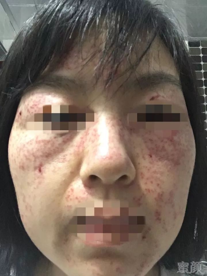 https://img.miyanlife.com/mnt/timg/181228/1225062a4-2.jpg