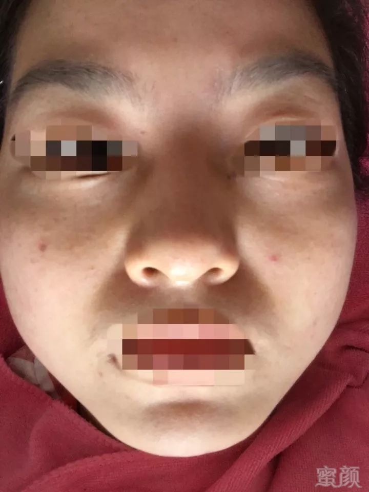 https://img.miyanlife.com/mnt/timg/181228/12250K242-6.jpg