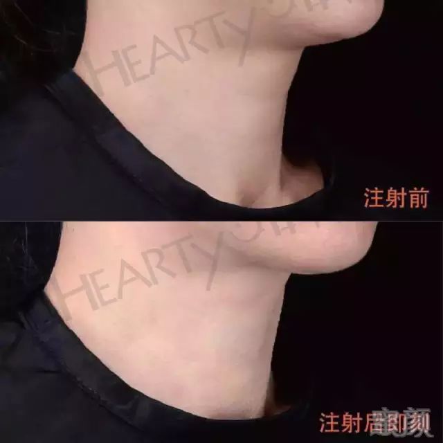 https://img.miyanlife.com/mnt/timg/181228/122K3J96-3.jpg