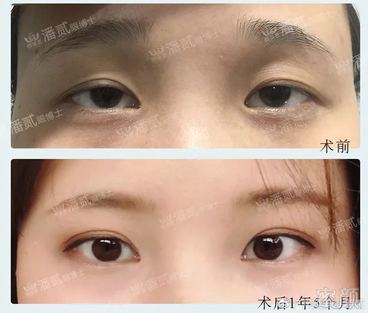 https://img.miyanlife.com/mnt/timg/181228/12404KW0-4.jpg