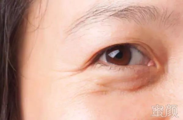 https://img.miyanlife.com/mnt/timg/181229/1102562N4-1.jpg