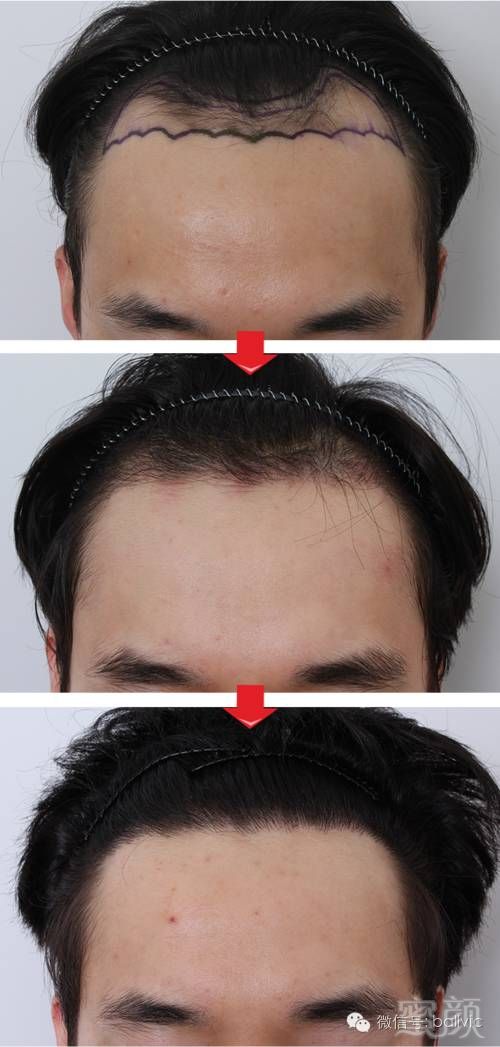https://img.miyanlife.com/mnt/timg/181229/1240021345-9.jpg