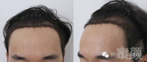 https://img.miyanlife.com/mnt/timg/181229/1240021354-6.jpg