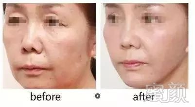 https://img.miyanlife.com/mnt/timg/181229/13024950N-15.jpg