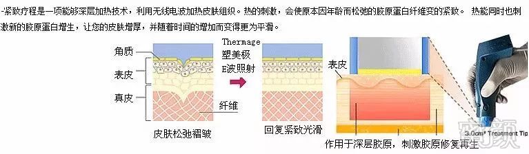 https://img.miyanlife.com/mnt/timg/181229/13024HC5-1.jpg
