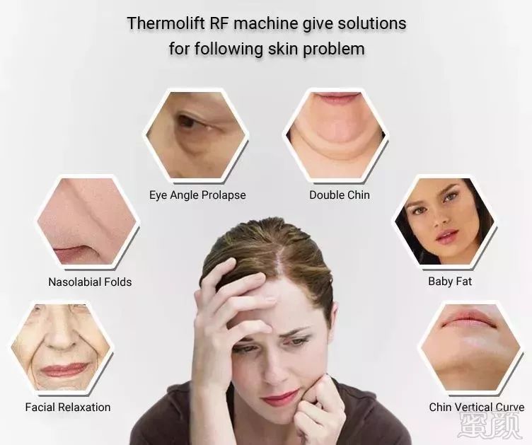 https://img.miyanlife.com/mnt/timg/181229/13024a236-10.jpg