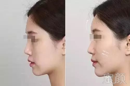 https://img.miyanlife.com/mnt/timg/181230/1206422I2-2.jpg