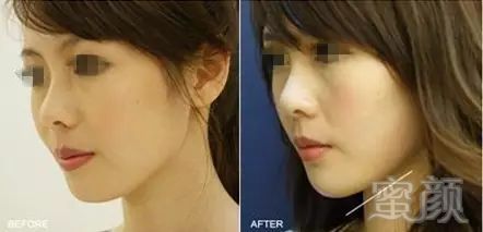 https://img.miyanlife.com/mnt/timg/181230/120643D42-6.jpg