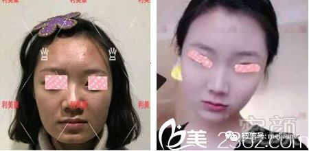 https://img.miyanlife.com/mnt/timg/181230/120H56154-1.jpg