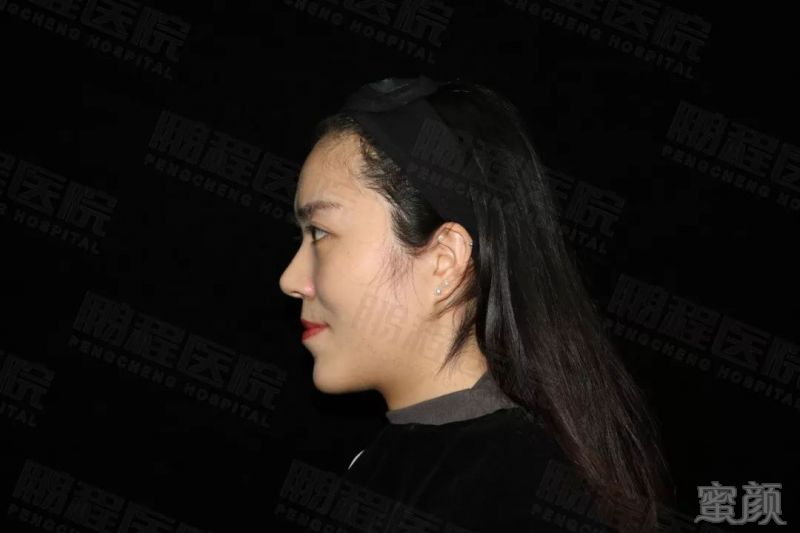 https://img.miyanlife.com/mnt/timg/181230/1214021195-5.jpg