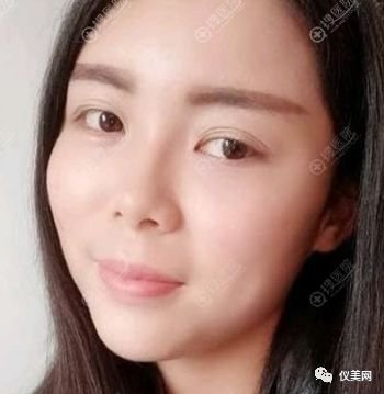 https://img.miyanlife.com/mnt/timg/181230/12141013V-2.jpg
