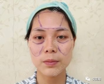 https://img.miyanlife.com/mnt/timg/181230/1214102594-0.jpg