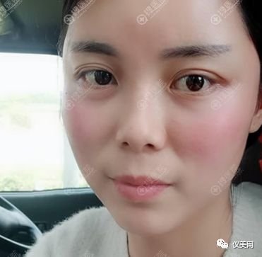 https://img.miyanlife.com/mnt/timg/181230/1214104F9-1.jpg